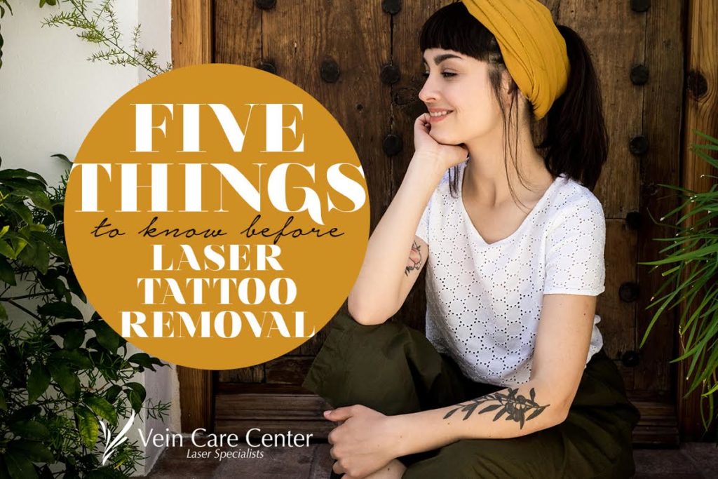things to know about laser tattoo removal