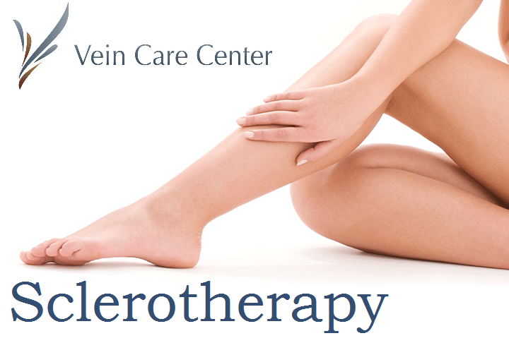 sclerotherapy patient ohio