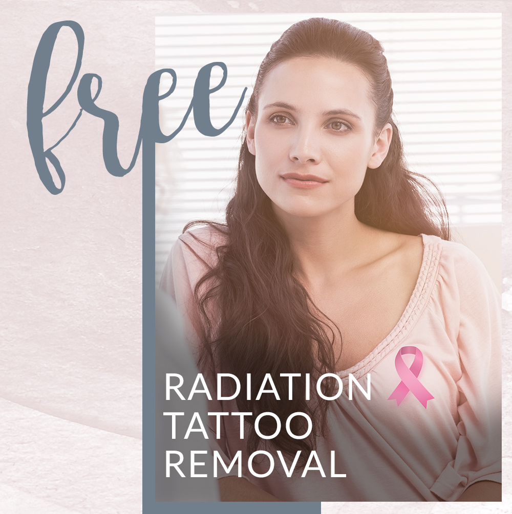 radiation tattoo removal