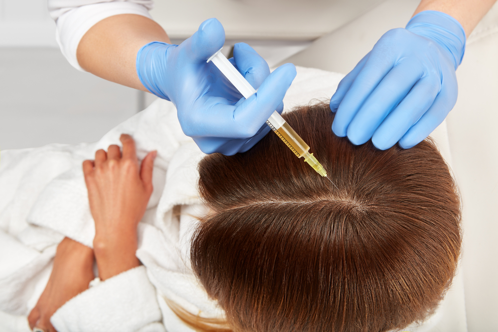 How Does PRP Hair Restoration Work and is it Permanent?