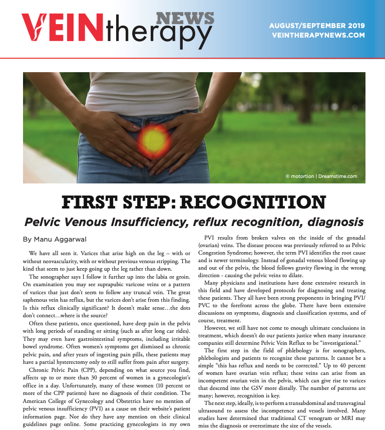 vein care center in the news